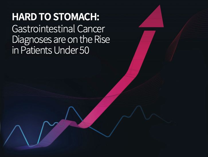Hard To Stomach The Rise Of Gastrointestinal Cancers In Patients Under 50