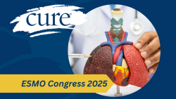 Frontline Alecensa Extends Survival in Advanced ALK-Positive Lung Cancer