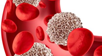 Updated Analysis Supports Evaluation of Second-Line Fedratinib to Treat Myelofibrosis