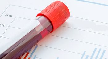 Image of blood test.