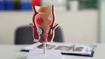 Updated data from GOBLET Cohort 4 demonstrated activity with Reolysin plus Tecentriq in patients with third-line metastatic squamous cell anal carcinoma: © stock.adobe.com.