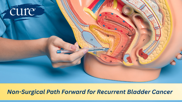 Image of bladder