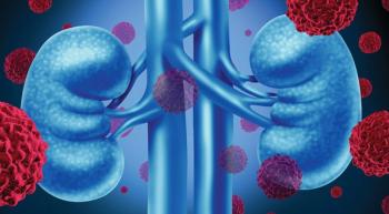 Illustration of kidneys with tumors surrounding them. 