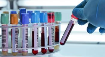 Image of a doctor wearing a blue rubber glove, holding a vial of blood next to a rack of seven other vials.