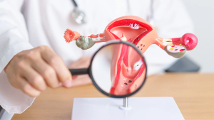 Dana-Farber Expert Explains Rina-S Data in Platinum-Resistant Ovarian Cancer
