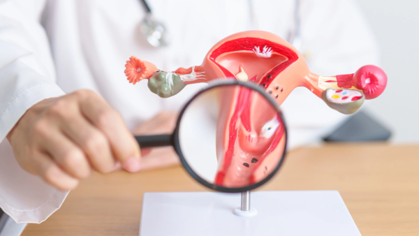 Dana-Farber Expert Explains Rina-S Data in Platinum-Resistant Ovarian Cancer