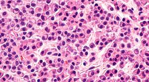 image of myeloma represented with colors of pink and purple.