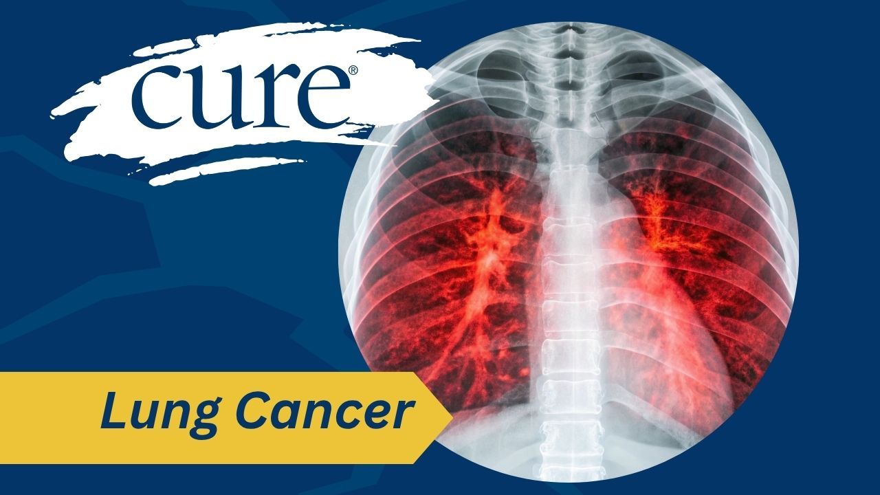 lung cancer