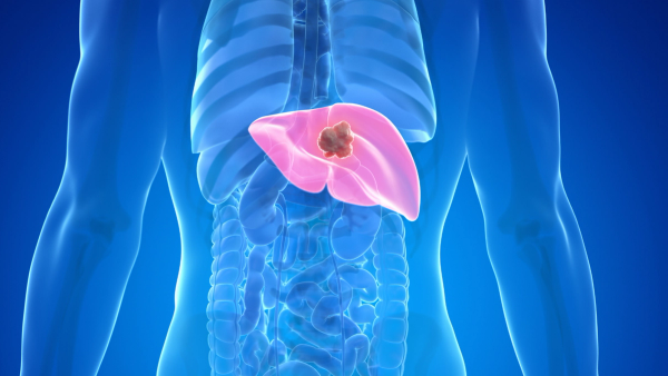 Image of liver