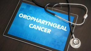 Overview of diagnosis, stage-based treatments, side effects and follow-up to help patients with cancer understand care choices and expectations.