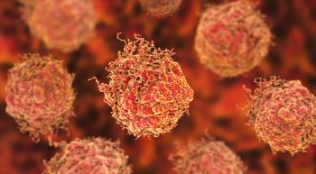 Lynparza Significantly Improves Survival in Subset of Patients with Metastatic Prostate Cancer