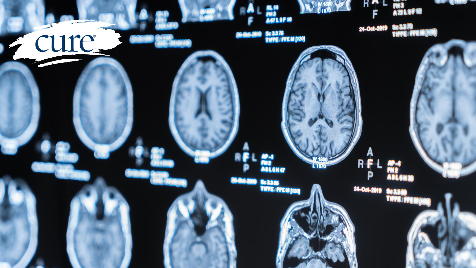Image of brain
