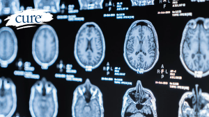 Image of brain
