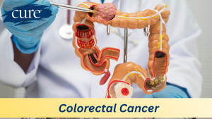 Image of colon