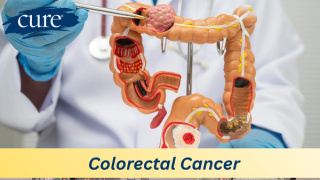 Image of colon