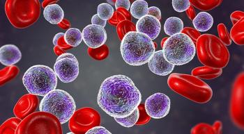 DLBCL cells