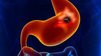 Illustration of stomach.