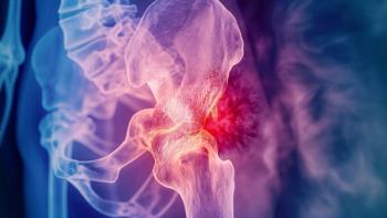 The FDA approved the denosumab biosimilars Enoby and Xtrenbo for patients on hormone therapies for breast or prostate cancer that weaken bones: © stock.adobe.com.