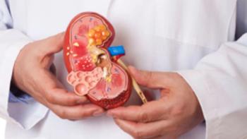 kidney cancer