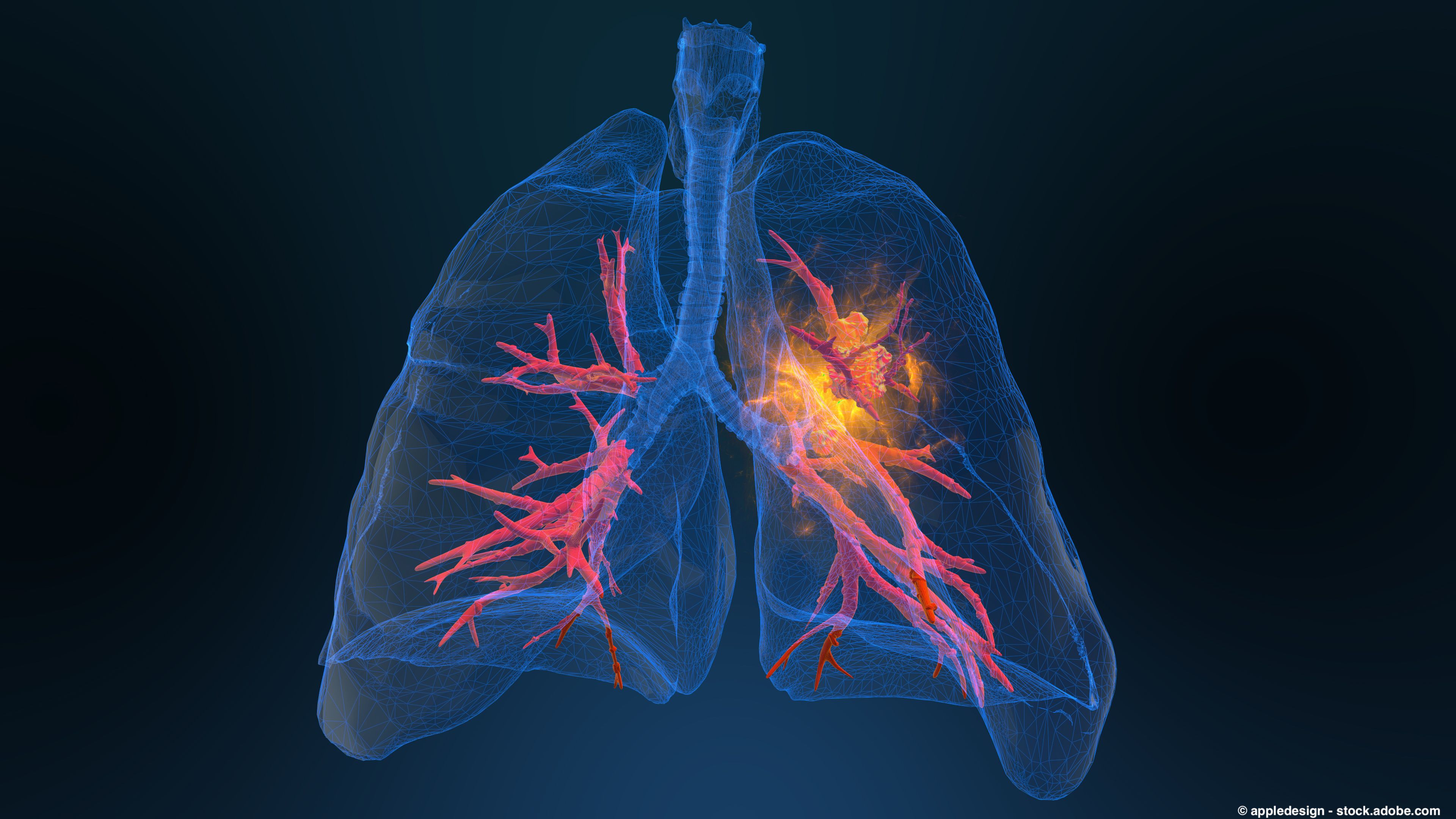 Subcutaneous Keytruda plus berahyaluronidase alfa meets phase 3 trial end points in non–small cell lung cancer.