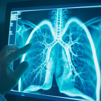 Lutathera demonstrated antitumor activity in metastatic bronchopulmonary neuroendocrine tumors: © stock.adobe.com.