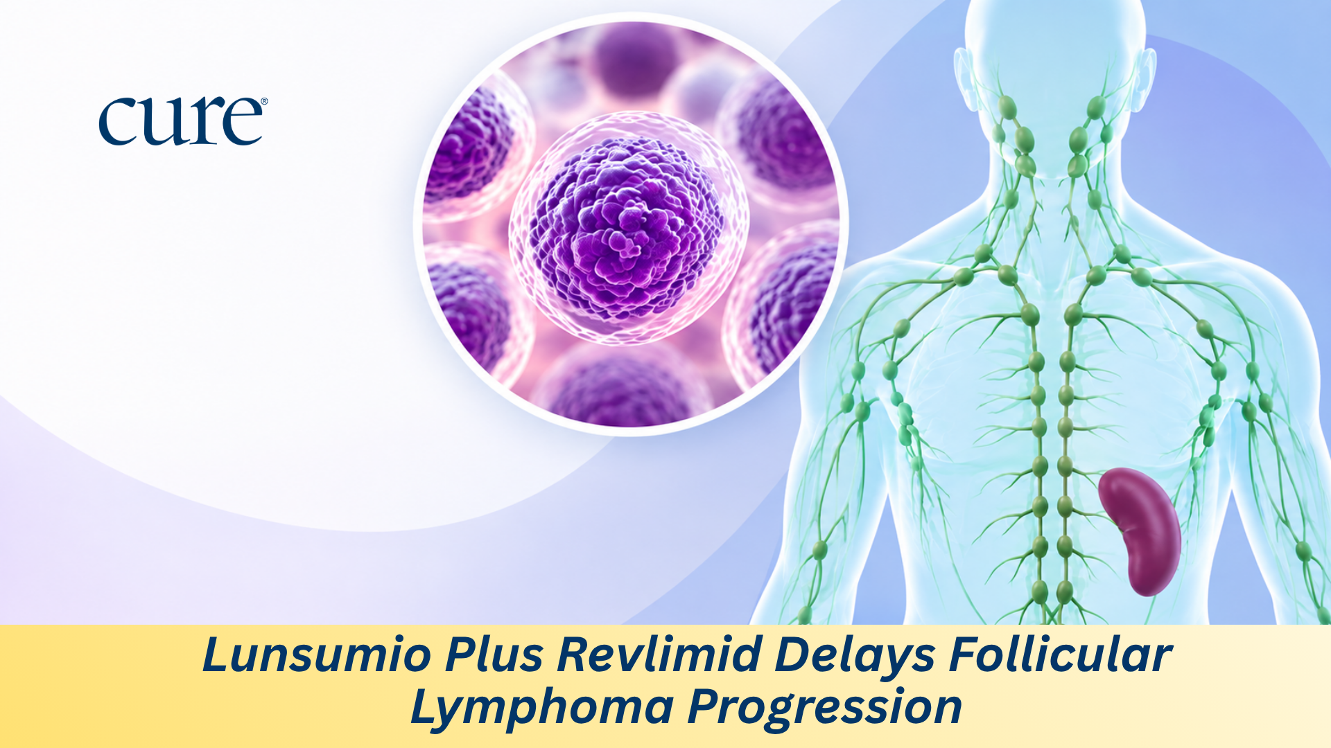 Follicular Lymphoma