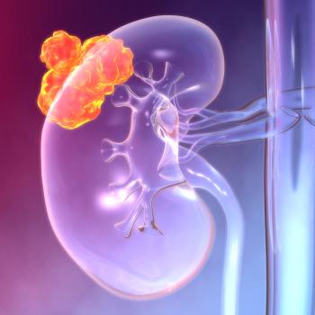 Researchers are exploring the use of CAR T-cell therapy in clear cell renal cell carcinoma, a type of kidney cancer: © stock.adobe.com.