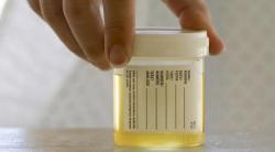 Urine Test Decreases Cystoscopies in Patients With Bladder Cancer