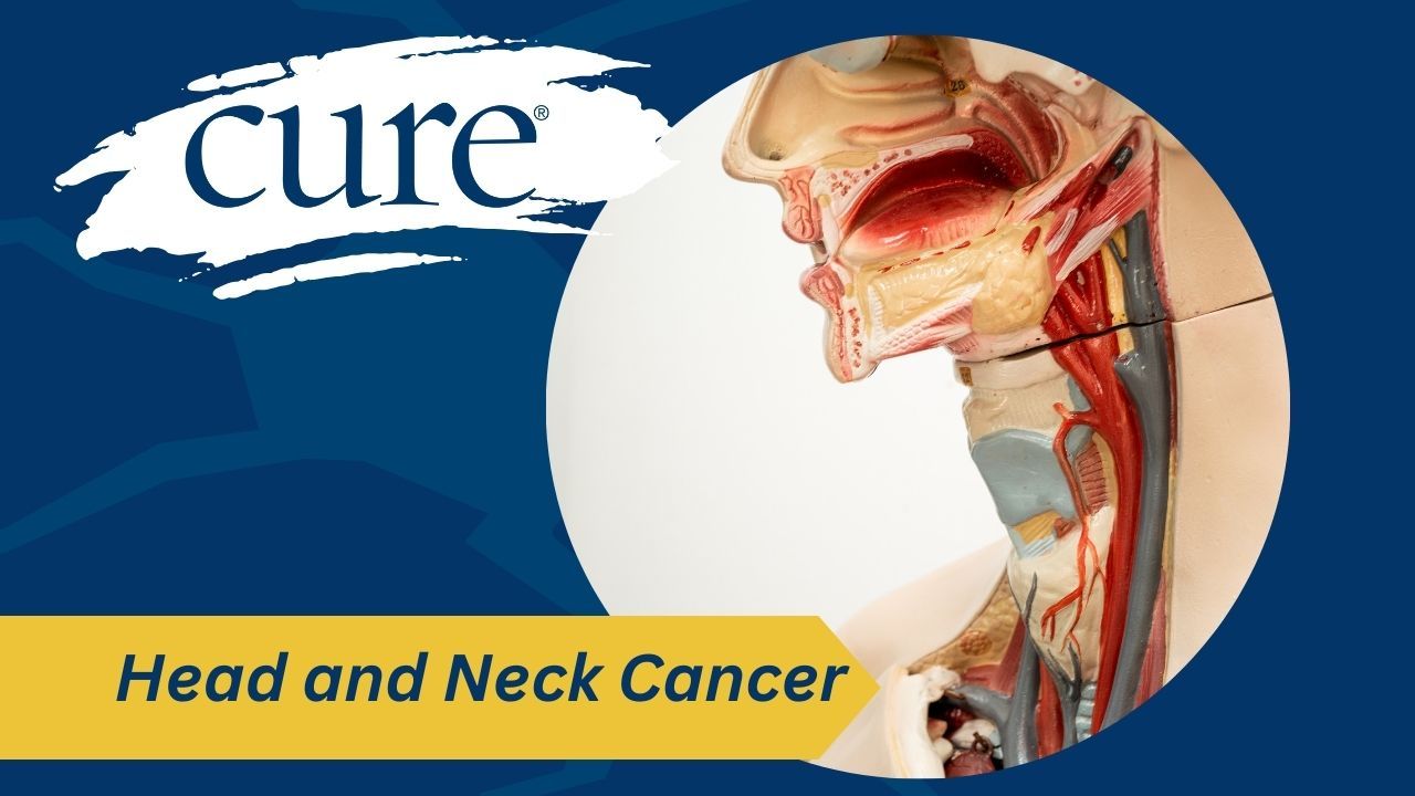 nasopharyngeal cancer