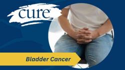 Inlexzo Offers New Option for Patients With Unresponsive Bladder Cancer