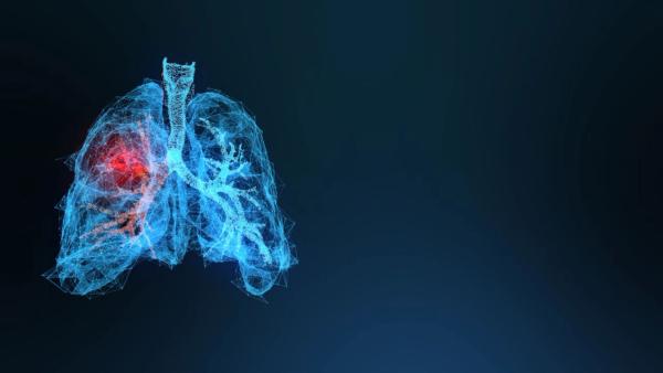 Dr. Benjamin Herzberg spotlighted some of the “weird and wacky” new ideas in the field of targeted therapies for the treatment of lung cancer: © stock.adobe.com.