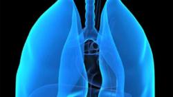 Understanding Emerging Cell Therapy in Lung Cancer 