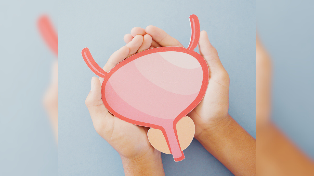 Trial data showed a 62% complete response rate at 6 months with detalimogene coraplasmid among patients with high-risk, BCG-unresponsive bladder cancer.