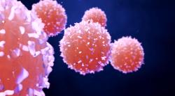 Outpatient CAR-T Cell Therapy May Be Safe in Hematologic Malignancies