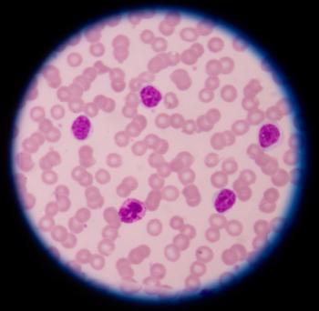 leukemia cells