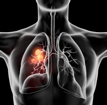 Illustration of lungs.