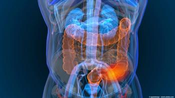 Image of GI cancer.