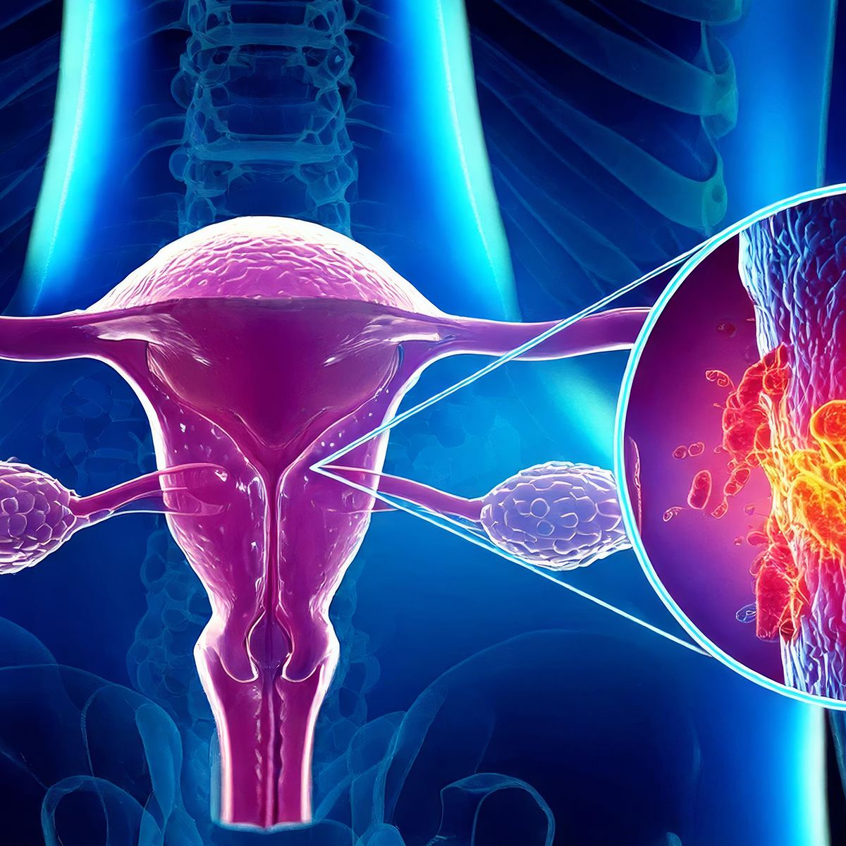 The FDA has granted fast track designation to stenoparib for patients with advanced ovarian cancer: © stock.adobe.com.