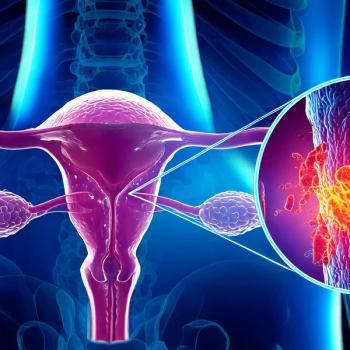 Rina-S led to a 50% response rate, including two complete responses, in heavily pretreated advanced endometrial cancer: © stock.adobe.com.