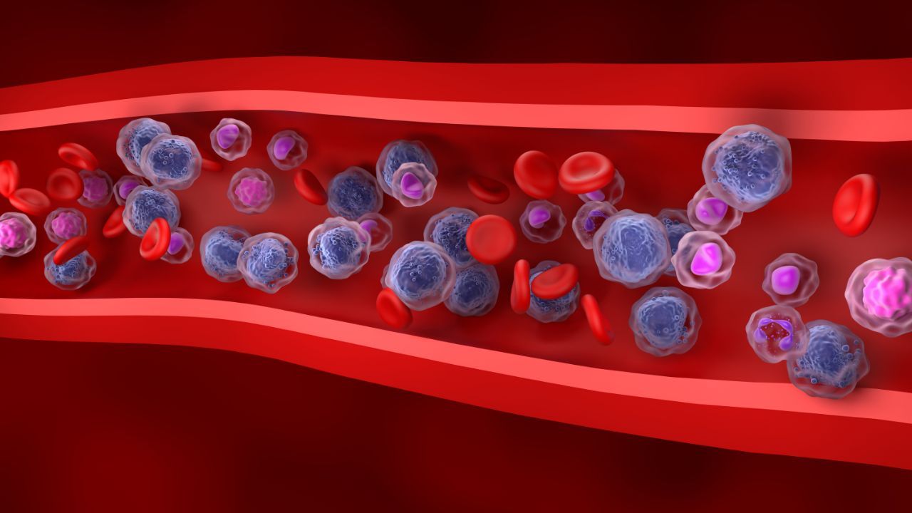 The U.S. FDA has granted orphan drug designation to M2T-CD33 for the treatment of patients with acute myeloid leukemia: © stock.adobe.com.