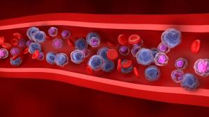 The U.S. FDA has granted orphan drug designation to M2T-CD33 for the treatment of patients with acute myeloid leukemia: © stock.adobe.com.