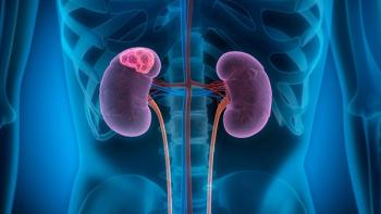 The FDA has granted fast track designation to ITM-94 as a diagnostic agent for the detection of the most common type of kidney cancer: © stock.adobe.com.