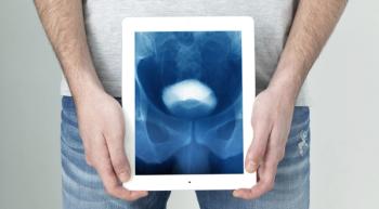 bladder X-Ray