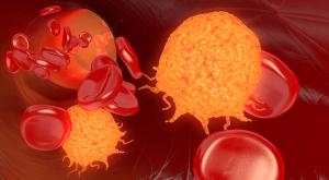 Survival and Treatment Response May Be Further Improved With Brukinsa Versus Imbruvica for CLL/SLL
