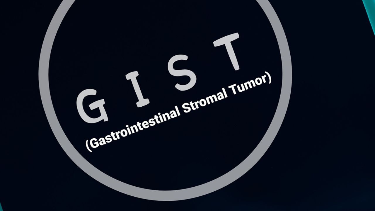 <![CDATA[Research Underway In SDH-Deficient GIST Treatment]]>