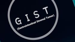 Research Underway In SDH-Deficient GIST Treatment