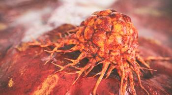triple-negative breast cancer cell