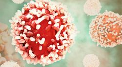 Monjuvi Combination May Improve Survival in Follicular Lymphoma