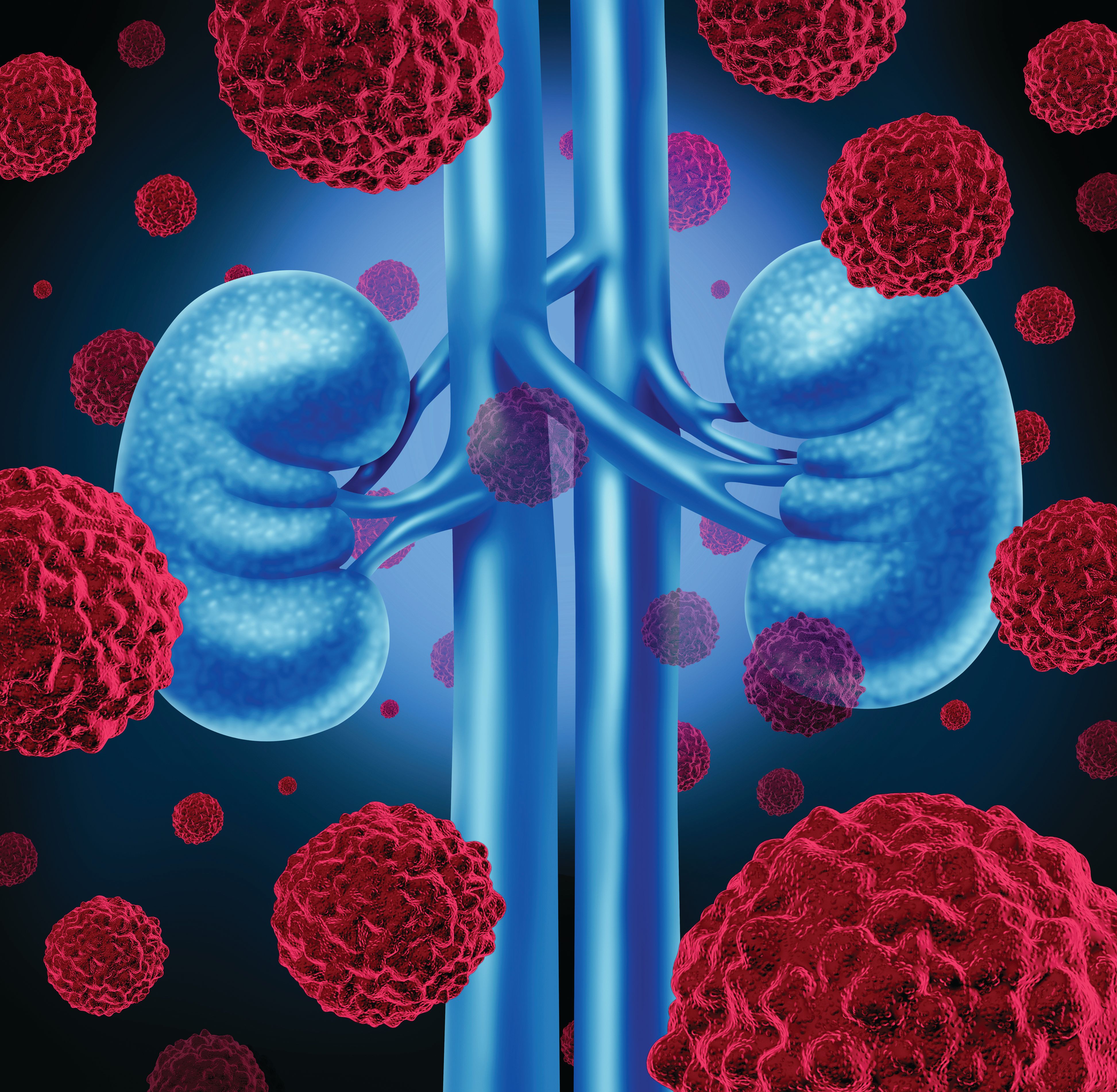 Image of kidney