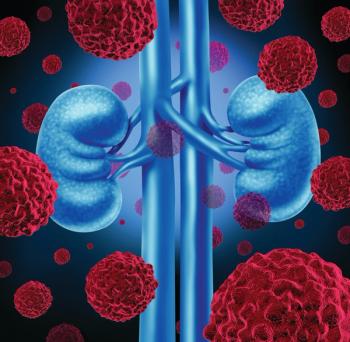 Image of kidney